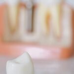 Zastosowanie protetyki zębowej