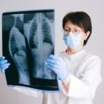 Jakie są objawy raka płuc i jak można go wykryć na wczesnym etapie?